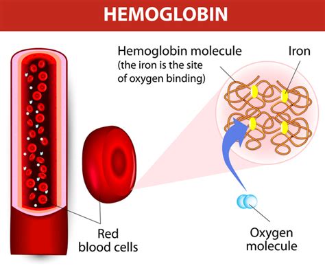 Hypochromic Microcytic Anemia With Iron Overload Medlineplus Genetics