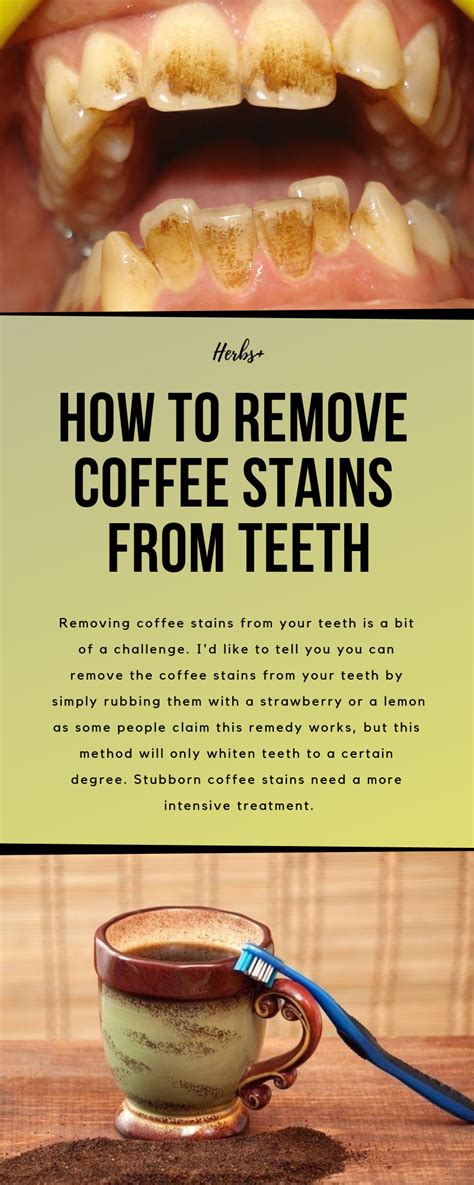 We all love a morning brew to begin the start to our day. How To Remove Coffee Stains From Teeth | Coffee stain ...