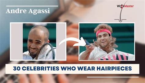 30 Celebrities Who Wear Hairpieces Before And After Pictures