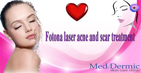Medidermic Fotona Laser Acne And Scar Treatment
