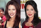 Hunter Tylo Plastic Surgery - A Surgical Mistake