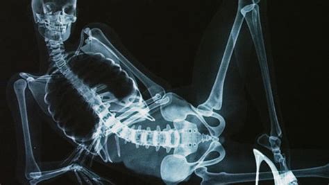 Xxx X Ray Pictures Naked Anatomy Lesson Shocks Senses Cbs News