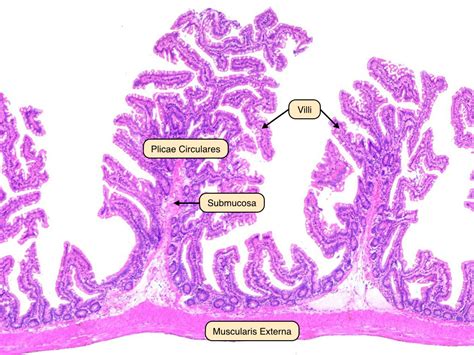 Ileum