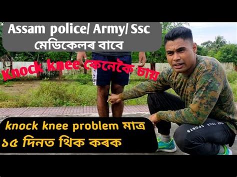Knock Knee Correction Exercise In Assamese Assam Police Army Ssc Gd