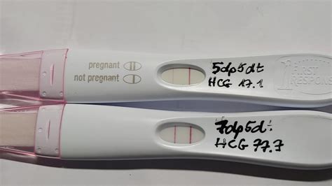 5dp5dt 10 Dpo And 7dp5dt 12 Dpo Fet Frer And Predictor Early Hcg