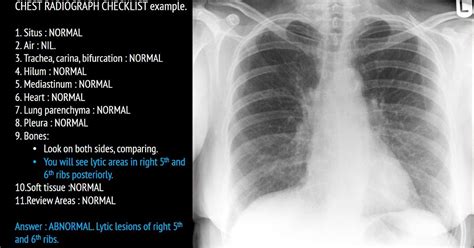 Ultimate Radiology Chest Radiograph Checklist For Frcr 2b Rapid Reporting
