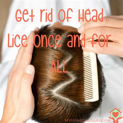 50 How To Get Rid Of Hair Lice Png Do My Hair Meaning