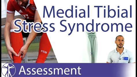 Medial Tibial Stress Syndrome Mtss Shin Splints Youtube Hot Sex Picture