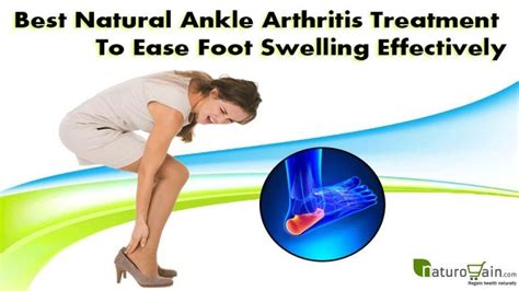 Best Natural Ankle Arthritis Treatment To Ease Foot Swelling Effectiv