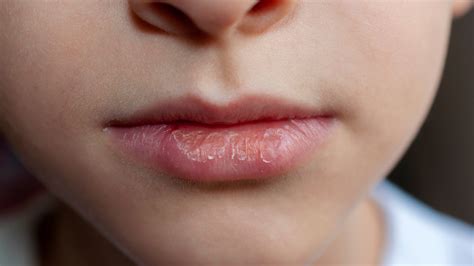 underactive thyroid symptoms dry lips