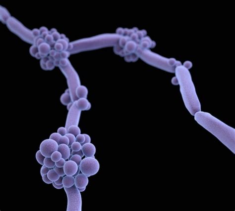 Study Shines Light On Spread Of Candida Auris
