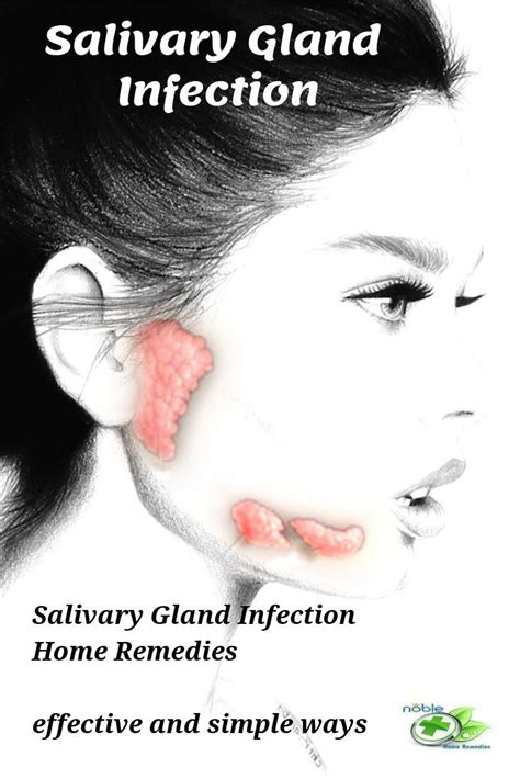 Swollen Salivary Glands Dehydration Createstrong