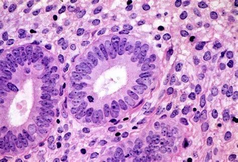 Epitélios Glandulares As Células Do Tecido Epitelial Glandular