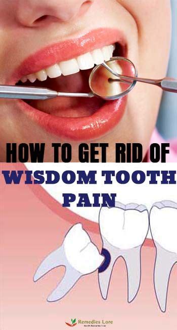 Wisdom teeth are a third set of molars in the back of your mouth. Pin on Pedal