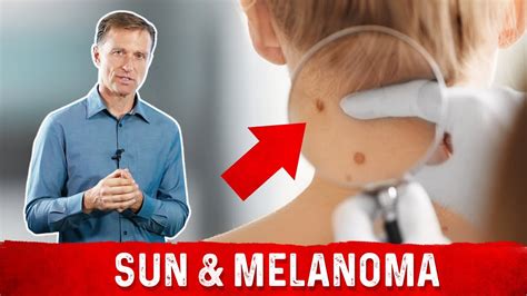 Does The Sun Cause Or Prevent Melanomas Youtube