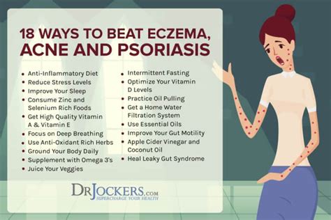 Eczema Symptoms Causes And Support Strategies