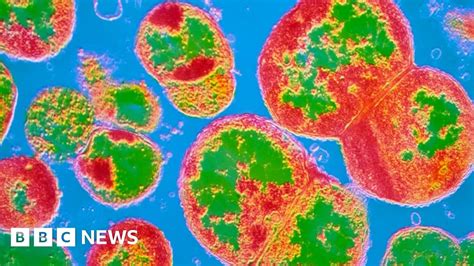 Australia Gonorrhoea Cases Surge Bbc News
