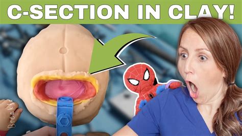 Obgyn Reacts Playdough C Section Youtube