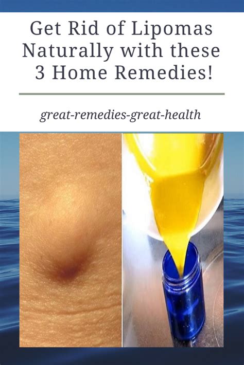 Image By Be Extra Healthy Now On Beauty Remedies Home Remedies