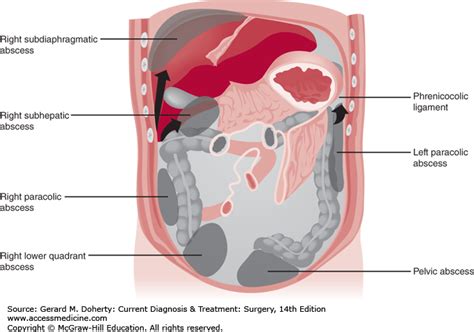Right Lower Quadrant Anatomy Definition Ovulation Symptoms