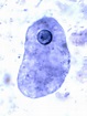 Parasitology - Entamoeba coli? | Entamoeba histolytica, Medical ...