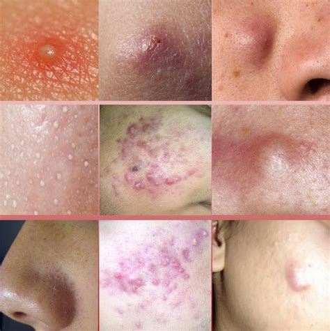 Dermatology Treatments For Skin Medical Conditions