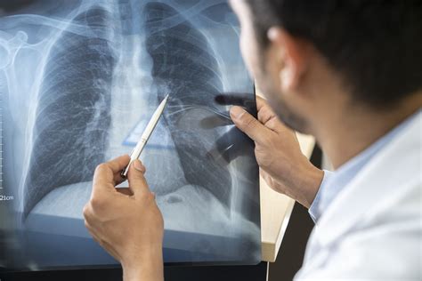 What Is Pulmonology History Pulmonologists Conditions