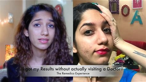 The Remedico Experience How I Treated My Skin Sitting At Home Online
