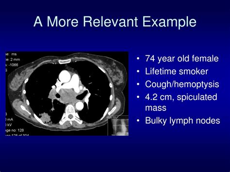 Ppt Mediastinal Staging For Lung Cancer Powerpoint Presentation Free