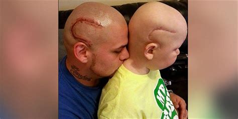 Awesome Dad Gets Tattoo To Match Brave Sons Cancer Scar