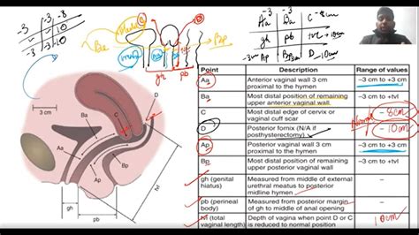 Basics Of Urogynecology Anatomy Of Pelvis Pelvic Organ Prolapse