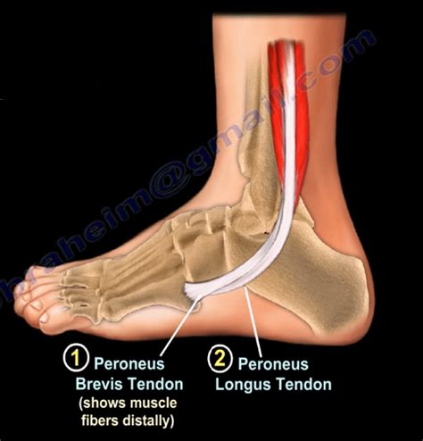 Peroneal Tendon Subluxation Healthcare Medicine Orthopedic Surgery