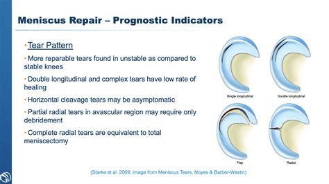 3 Types Of Meniscus Tear Treatment Knee Specialist Baton Rouge La