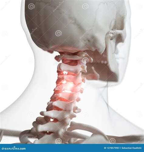 Una Espina Dorsal Cervical Dolorosa Stock De Ilustración Ilustración