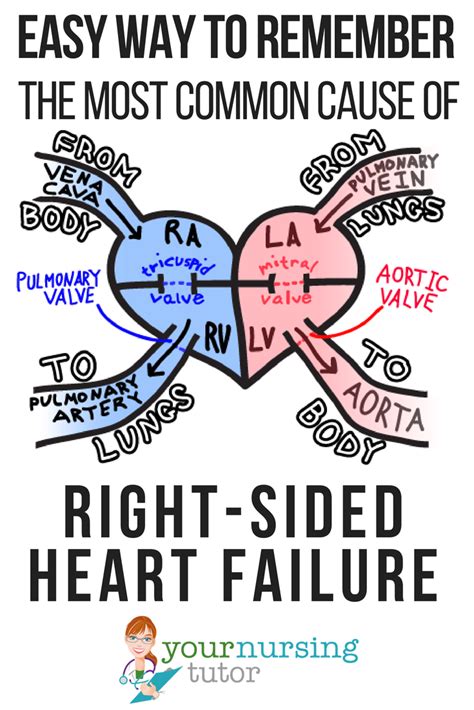 Easily Remember The Most Common Cause Of Right Sided Heart Failure