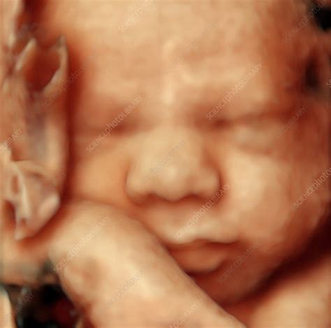 32 Week Foetus 3 D Ultrasound Scan Stock Image C0155000 Science
