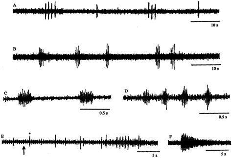 Trigeminal Nerve Discharge Recorded From The Same B Marinus Brainstem Download Scientific