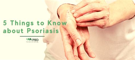 5 Things To Know About Psoriasis