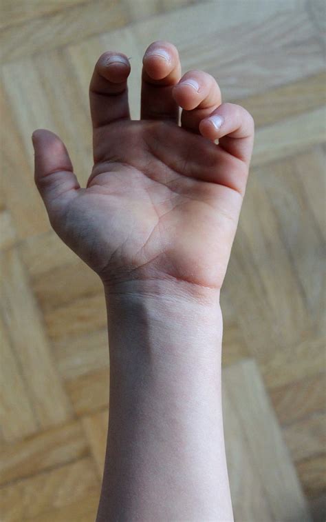 Free Photo Hand Fingers Veins Palm Hippopx