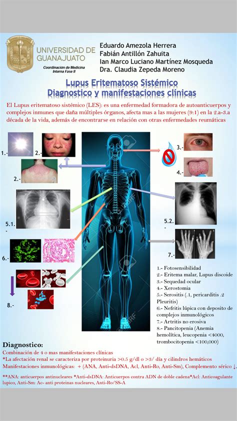 Lupus Eritematoso Sistemico Guia De Practicas Clinicas By Jako Perez