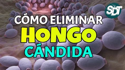 Cómo ELIMINAR el HONGO CÁNDIDA Remedios NATURALES para COMBATIR la cándida albicans