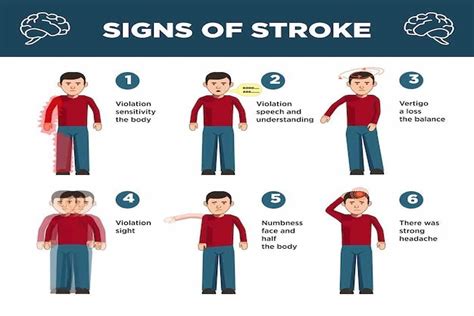 Kenali Gejala Stroke Ringan Dan Cara Mengatasinya