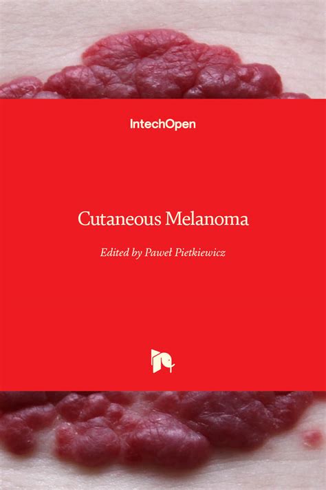 Cutaneous Melanoma Intechopen