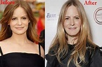 Jennifer Jason Leigh Plastic Surgery: facelifts, filler infusions, and ...
