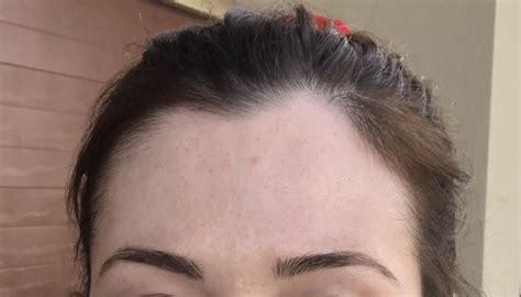 Hair Tied Back Amd Hairline Problems I Have A Widows Peak Cowlick