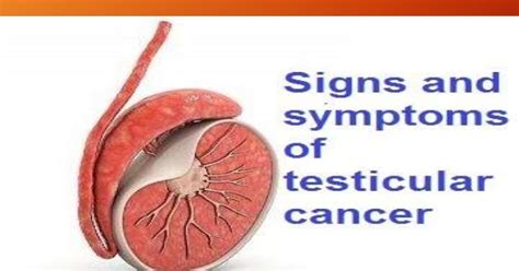 what causes testicular cancer cancer oz