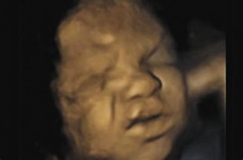 Do Foetuses Feel Pain Study Shows Unborn Babies Crying In The Womb