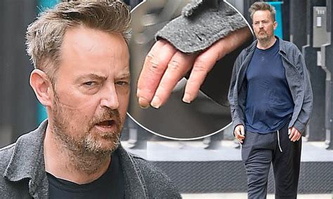 Matthew Perry Looks Disheveled With Long Dirty Fingernails As He