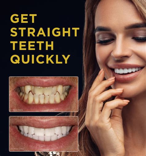quick straight teeth new malden dentist south london