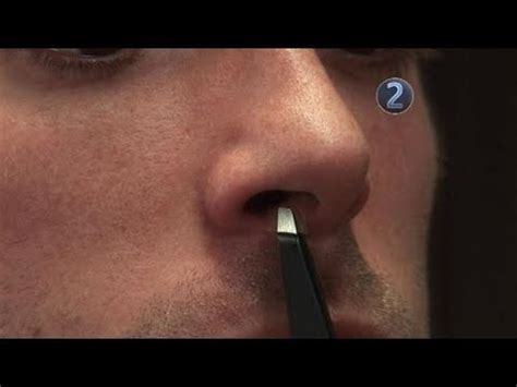 Acnes bacteria on your skin. How To Remove Your Nose Hair - YouTube